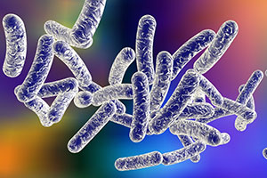 Legionnaire's disease